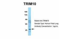 TRIM10 Rabbit anti-Human, Polyclonal, Novus Biologicals 0.1 mL; Unconjugated:Antibodies,